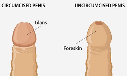 comparison of Circumcised vs Uncircumcised